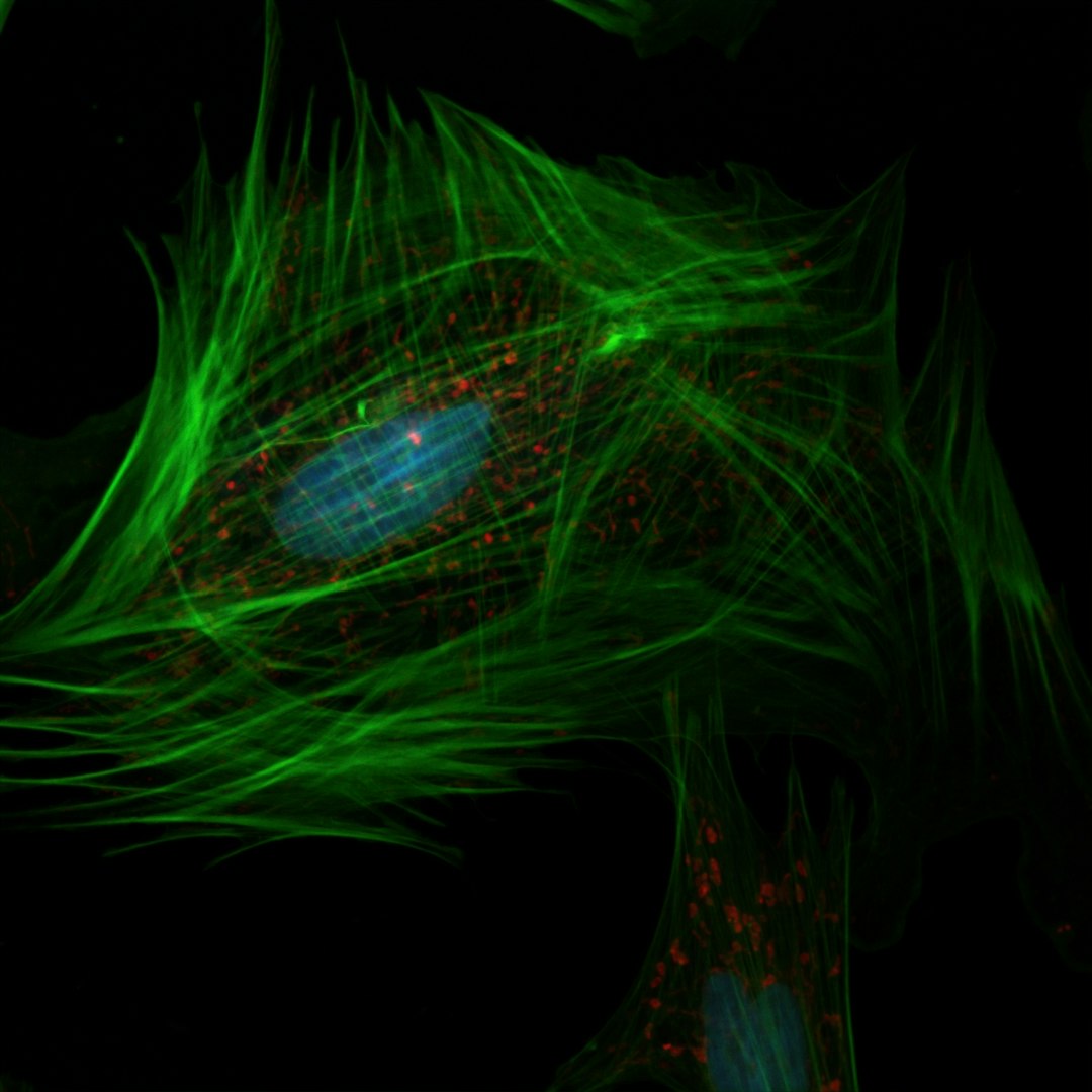 Fluorescent microscopy image of cells with green cytoskeletal fibres and blue nuclei